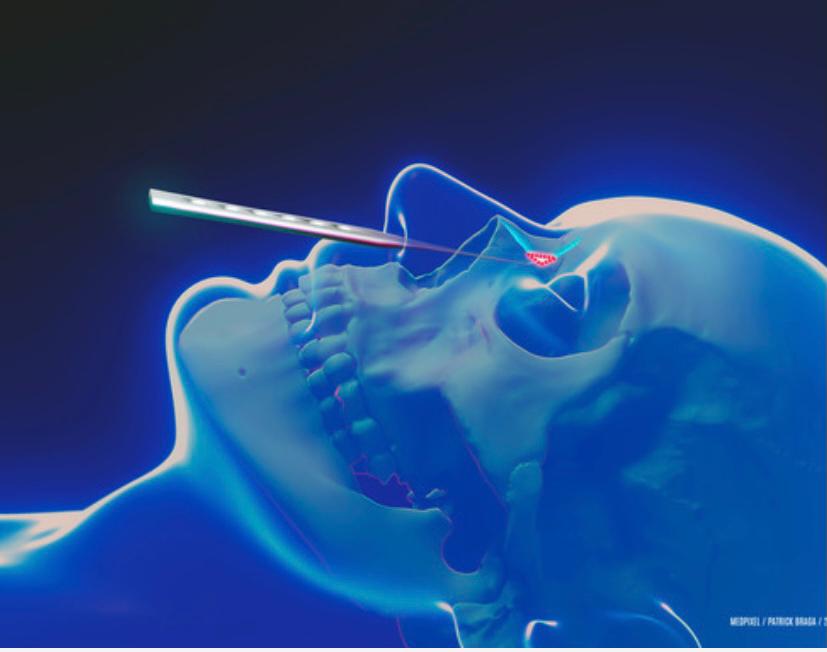 Computação gráfica 3D de anatomia craniofacial