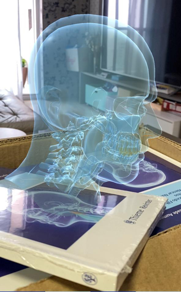 Realidade aumentada projetando anatomia craniofacial 3D sobre livro Thieme